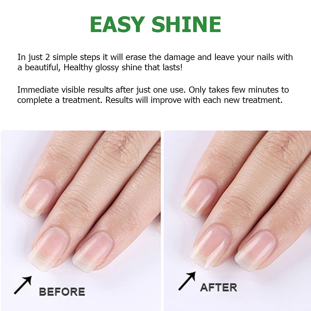 nail-buffing Shinner tool